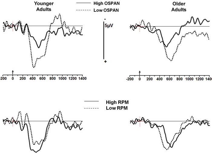 age-related-changes-electrophys-brumback