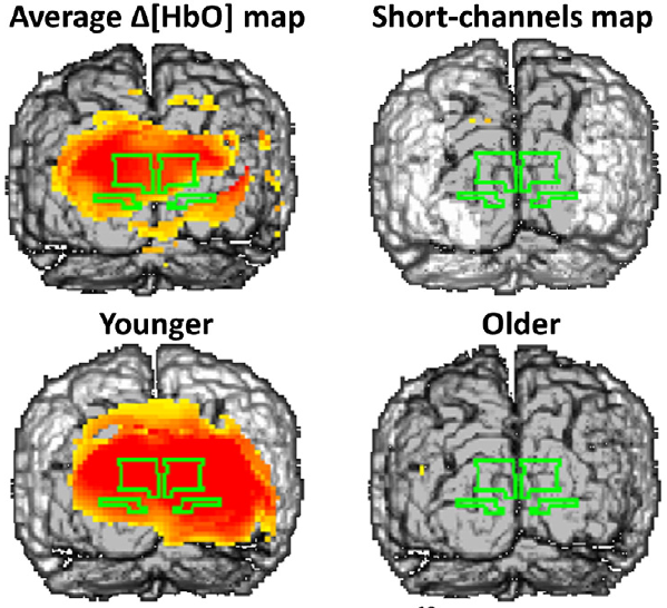 neurovascular-coupling-2014