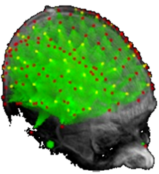 fast-optical-imaging-2010