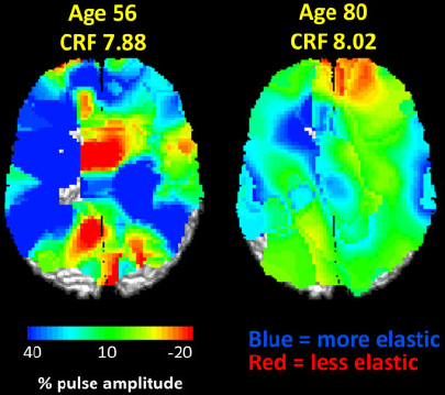 Taking-pulse-aging-2014